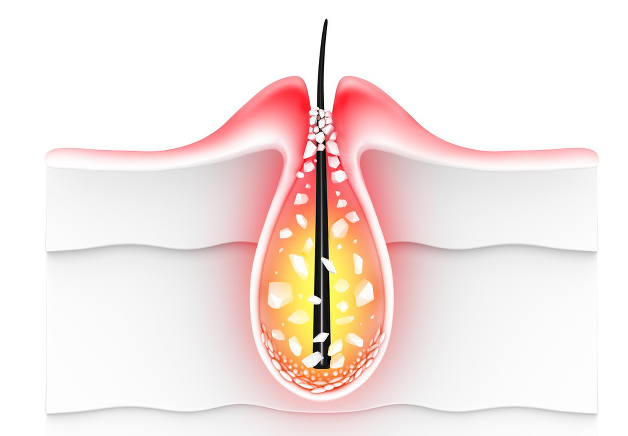 Liposomal Glutathione