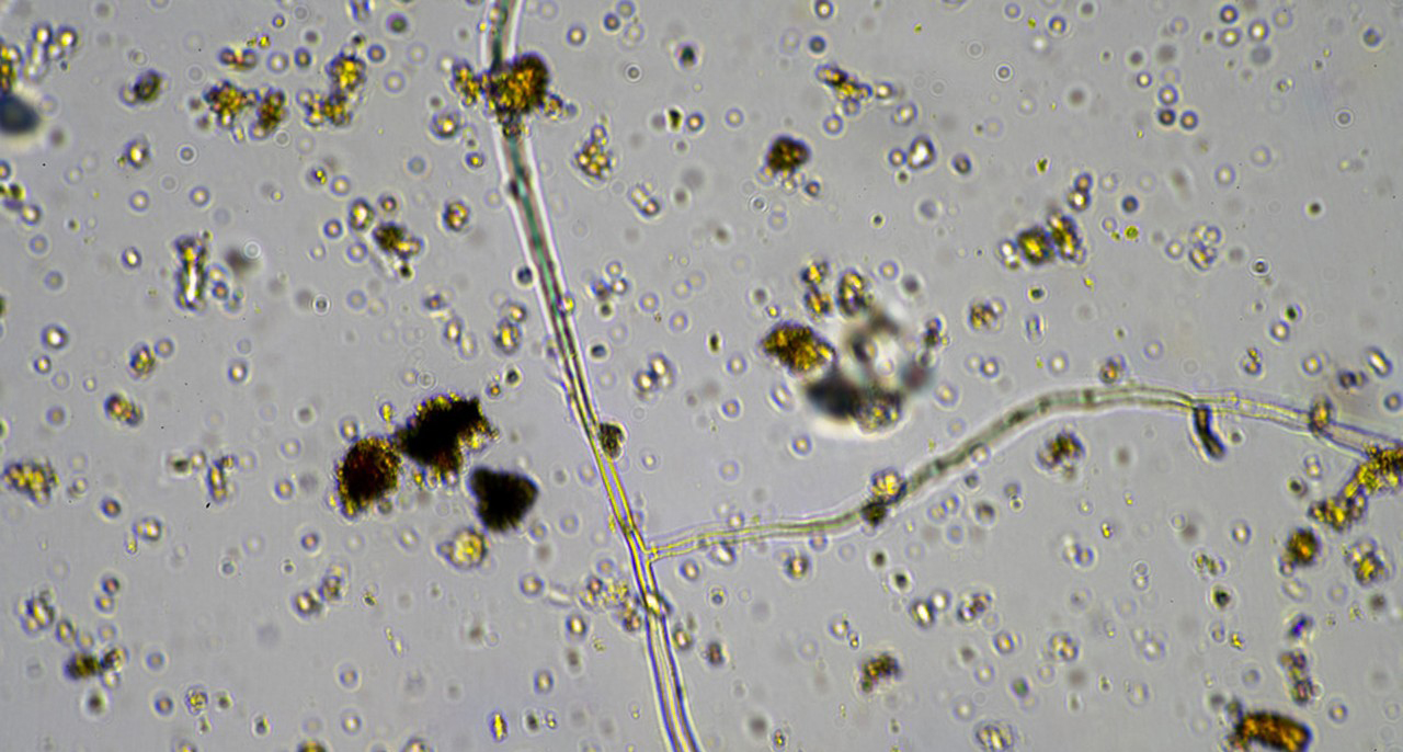 Bacillus Pumilus