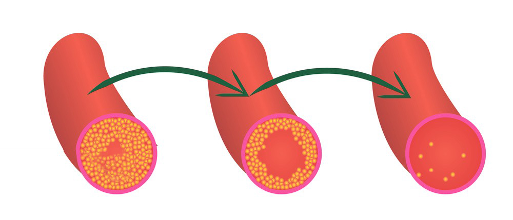 Chitosan Oligosaccharide