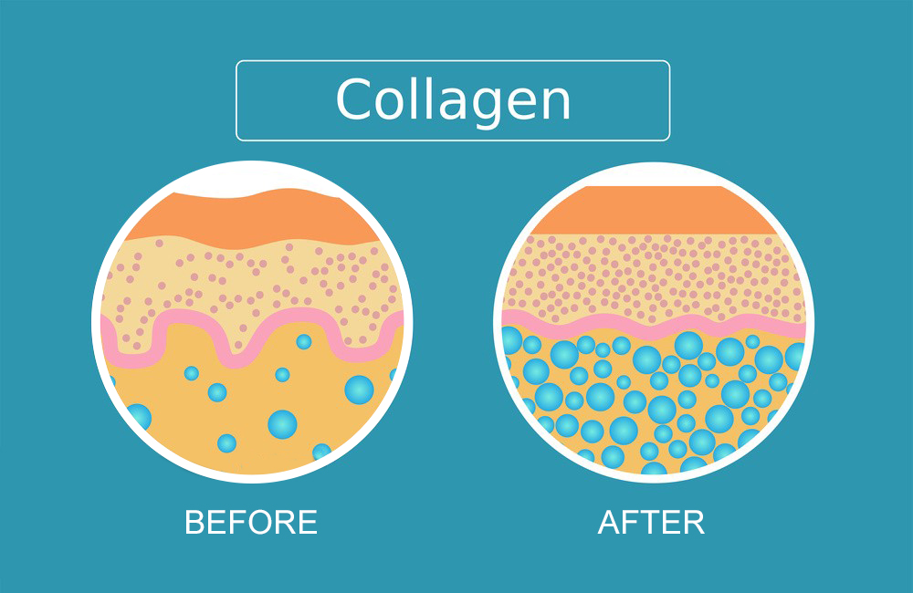 Collagen