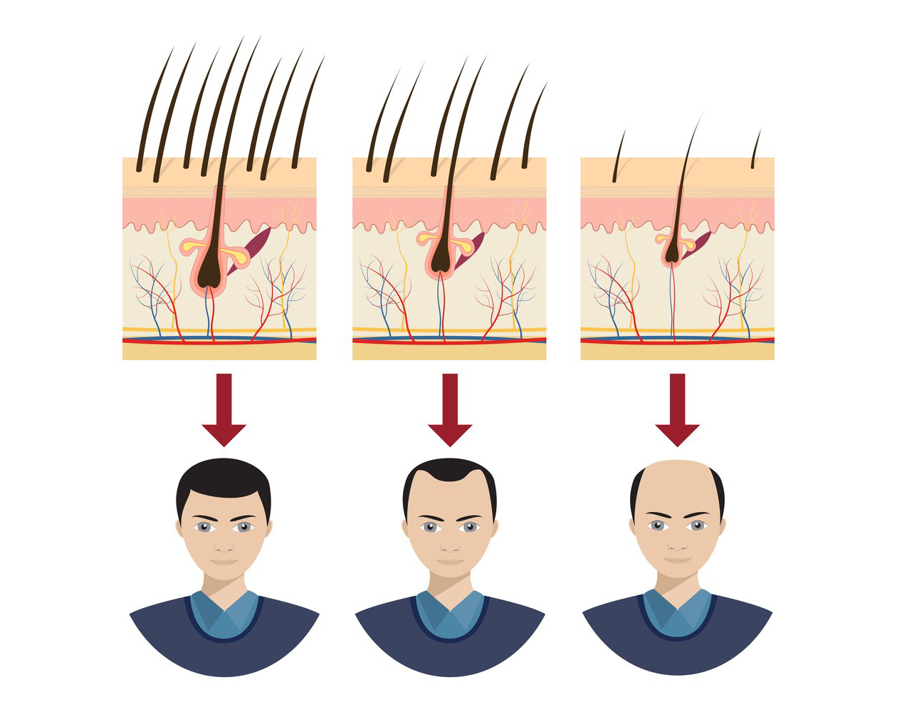 Minoxidil